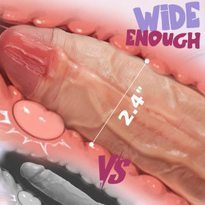 8 Inch Girth Realistic Thick Dildo, Real Skin Huge Dildo with Strong Suction Cup for Hands-Free Play, Big Silicone Dildos Adult Sex Toys for Men and Women